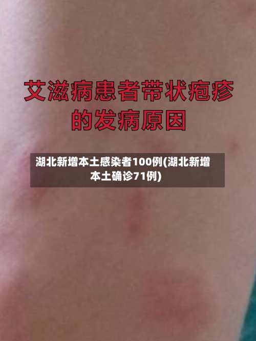 湖北新增本土感染者100例(湖北新增本土确诊71例)-第1张图片