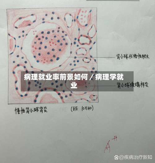 病理就业率前景如何／病理学就业-第1张图片