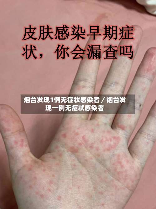 烟台发现1例无症状感染者／烟台发现一例无症状感染者-第1张图片