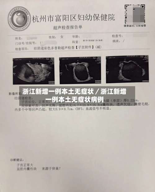 浙江新增一例本土无症状/浙江新增一例本土无症状病例-第2张图片