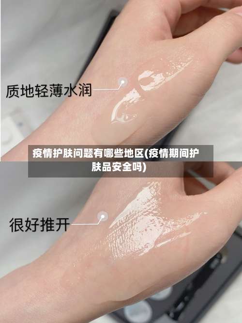 疫情护肤问题有哪些地区(疫情期间护肤品安全吗)-第3张图片