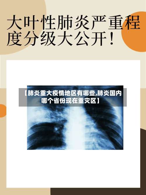 【肺炎重大疫情地区有哪些,肺炎国内哪个省份现在重灾区】-第1张图片